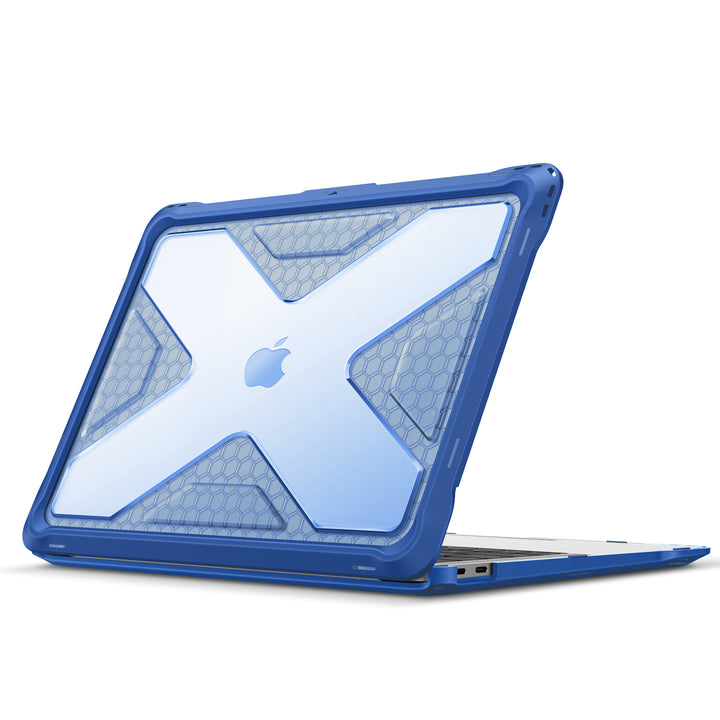 MacBook Air 13 Inch (2018-2021) Tuatara Case | Fintie