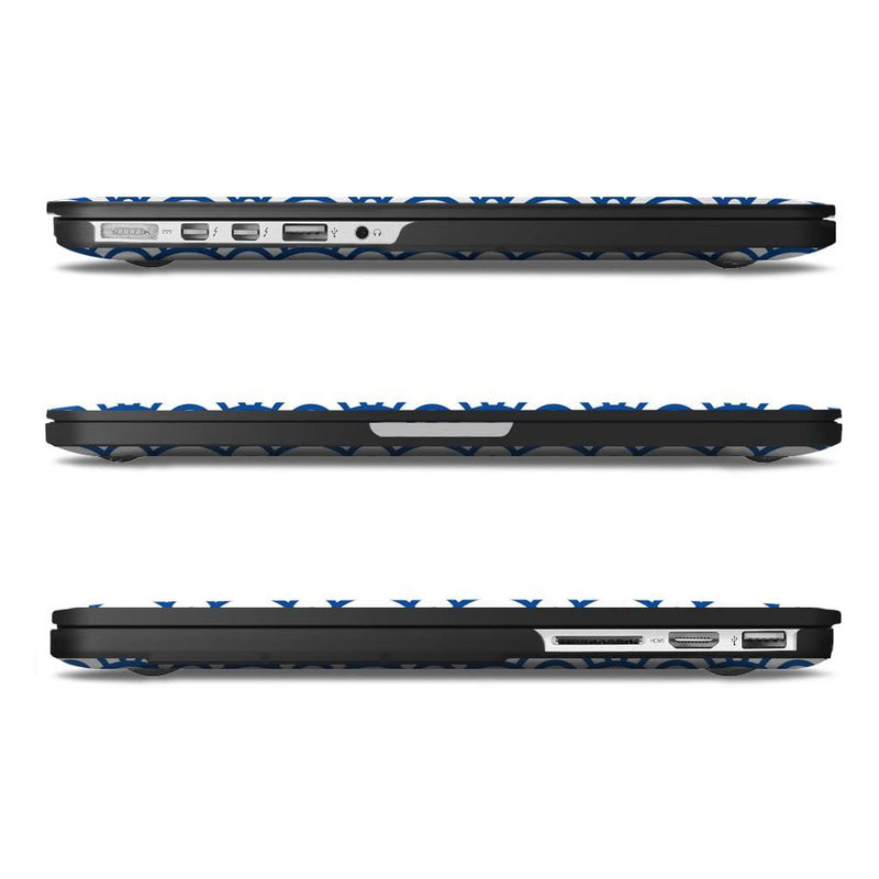 macbook pro 15 durable case